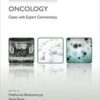 Challenging Concepts in Oncology Cases with Expert Commentary 1st Edition PDF