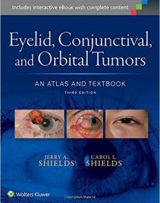 Eyelid, Conjunctival, and Orbital Tumors An Atlas and Textbook Third Edition PDF