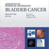 Advances in Surgical Pathology Bladder Cancer EPUB