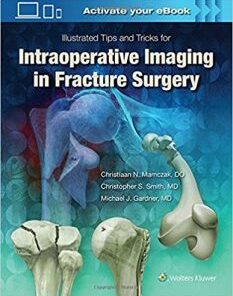 Illustrated Tips and Tricks for Intraoperative Imaging in Fracture Surgery EPUB