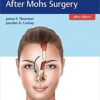 Facial Reconstruction After Mohs Surgery 1st Edition PDF & VIDEO