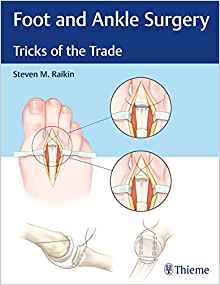 Foot and Ankle Surgery: Tricks of the Trade 1st Edition PDF