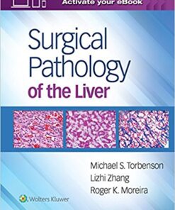 Surgical Pathology of the Liver First Edition PDF