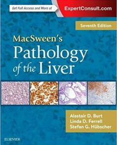 MacSween’s Pathology of the Liver, 7th Edition PDF