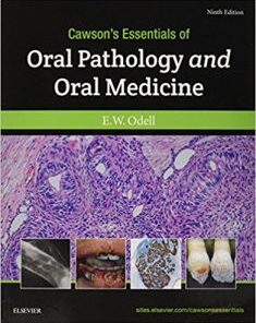 Cawson’s Essentials of Oral Pathology and Oral Medicine, 9th Edition PDF