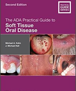 The ADA Practical Guide to Soft Tissue Oral Disease 2nd Edition PDF