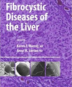 Fibrocystic Diseases of the Liver (Clinical Gastroenterology) 2010th Edition PDF