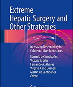 Extreme Hepatic Surgery and Other Strategies: Increasing Resectability in Colorectal Liver Metastases 1st ed. 2017 Edition PDF