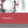 Alopecia, 1e 1st Edition PDF