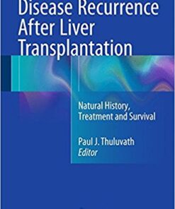 Disease Recurrence After Liver Transplantation: Natural History, Treatment and Survival 1st ed. 2016 Edition PDF