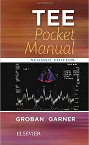 TEE Pocket Manual, 2nd Edition PDF