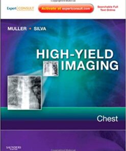 High-Yield Imaging: Chest: Expert Consult - 1e (HIGH YIELD in Radiology) 1st Edition PDF