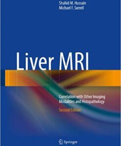 Liver MRI: Correlation with Other Imaging Modalities and Histopathology 2nd ed. 2015 Edition PDF