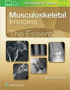Musculoskeletal Imaging The Essentials Epub