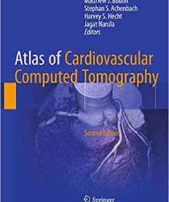 Atlas of Cardiovascular Computed Tomography 2nd ed. 2018 Edition PDF