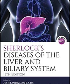 Sherlock's Diseases of the Liver and Biliary System 13th Edition PDF