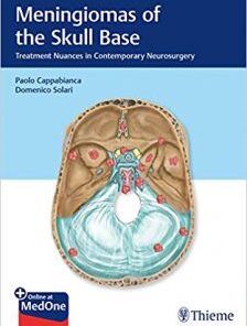 Meningiomas of the Skull Base: Treatment Nuances in Contemporary Neurosurgery PDF