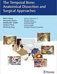 The Temporal Bone Anatomical Dissection and Surgical Approaches PDF