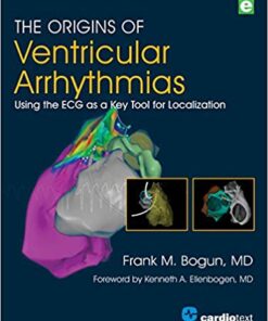 The Origins of Ventricular Arrhythmias: Using the ECG As a Key Tool for Localization 1st Edition epub