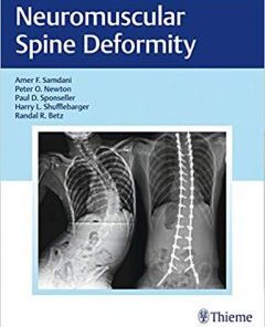 Neuromuscular Spine Deformity PDF
