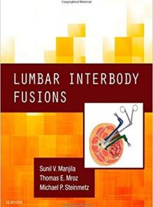 Lumbar Interbody Fusions PDF & Video