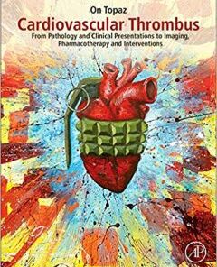 Cardiovascular Thrombus: From Pathology and Clinical Presentations to Imaging, Pharmacotherapy and Interventions PDF