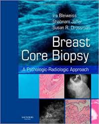 Breast Core Biopsy: A Pathologic-Radiologic Approach, 1e