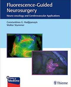 Fluorescence-Guided Neurosurgery: Neuro-oncology and Cerebrovascular Applications PDF