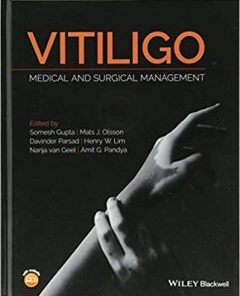 Vitiligo Medical and Surgical Management PDF