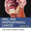Oral and Oropharyngeal Cancer 2nd Edition PDF Scaner
