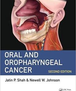Oral and Oropharyngeal Cancer 2nd Edition PDF Scaner