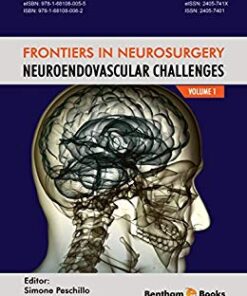 Frontiers in Neurosurgery Volume 1: NeuroEndovascular Challenges PDF