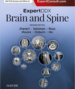 ExpertDDx: Brain and Spine 2nd Edition CHM
