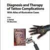 Diagnosis and Therapy of Tattoo Complications: With Atlas of Illustrative Cases (Current Problems in Dermatology, Vol. 52) 1st Edition