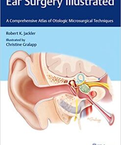 Ear Surgery Illustrated: A Comprehensive Atlas of Otologic Microsurgical TechniquesComprehensive, Illustrated Edition PDF