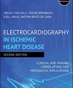 Electrocardiography in Ischemic Heart Disease: Clinical and Imaging Correlations and Prognostic Implications PDF