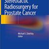 Stereotactic Radiosurgery for Prostate Cancer 1st ed. 2019 Edition