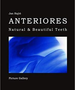 Anteriores-Natural & Beautiful Teeth-Picture Gallery (Korean Edition) (Korean) PDF