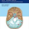Meningiomas of the Skull Base: Treatment Nuances in Contemporary Neurosurgery 1st Edition