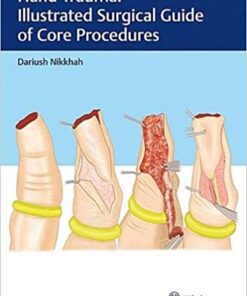 Hand Trauma: Illustrated Surgical Guide of Core Procedures Illustrated Edition PDF