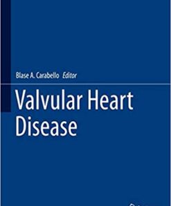 Valvular Heart Disease (Cardiovascular Medicine) 1st ed. 2020 Edition PDF
