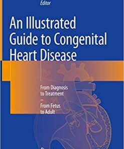 An Illustrated Guide to Congenital Heart Disease: From Diagnosis to Treatment – From Fetus to Adult 1st ed. 2019 Edition PDF
