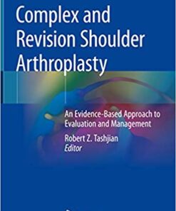 Complex and Revision Shoulder Arthroplasty: An Evidence-Based Approach to Evaluation and Management 1st ed. 2019 Edition PDF