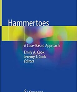 Hammertoes: A Case-Based Approach 1st ed. 2019 Edition PDF