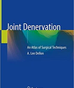 Joint Denervation: An Atlas of Surgical Techniques 1st ed. 2019 Edition PDF