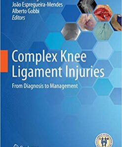 Complex Knee Ligament Injuries: From Diagnosis to Management 1st ed. 2019 Edition PDF