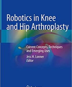 Robotics in Knee and Hip Arthroplasty: Current Concepts, Techniques and Emerging Uses 1st ed. 2019 Edition PDF