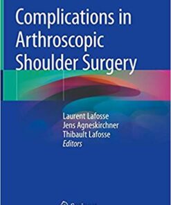 Complications in Arthroscopic Shoulder Surgery 1st ed. 2020 Edition PDF