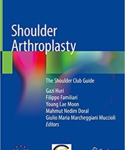 Shoulder Arthroplasty: The Shoulder Club Guide 1st ed. 2020 Edition PDF