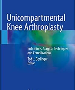 Unicompartmental Knee Arthroplasty: Indications, Surgical Techniques and Complications 1st ed. 2020 Edition PDF